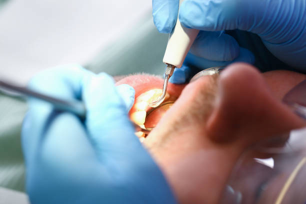 Best Dental Abscess Treatment in Cricket, NC