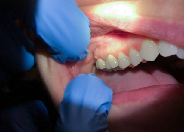 Best Emergency Pediatric Dental Care in Cricket, NC